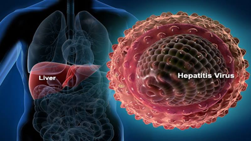 hepatitis akut misterius